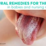 Natural Remedies For Thrush In Babies And Nursing Moms