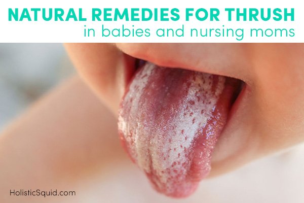 Natural Remedies For Thrush In Babies And Nursing Moms - Holistic Squid