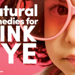 Natural Remedies For Pink Eye