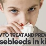 How To Treat And Prevent Nosebleeds In Kids
