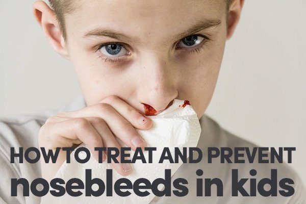 How To Treat And Prevent Nosebleeds In Kids - Holistic Squid