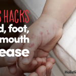 Virus Hacks: Hand, Foot, And Mouth Disease