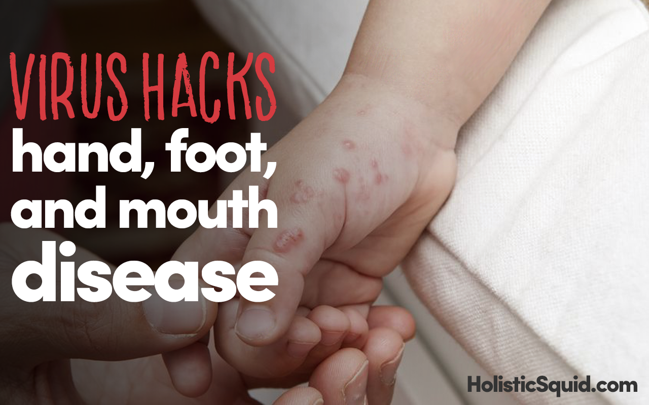 Virus Hacks: Hand, Foot, And Mouth Disease - Holistic Squid