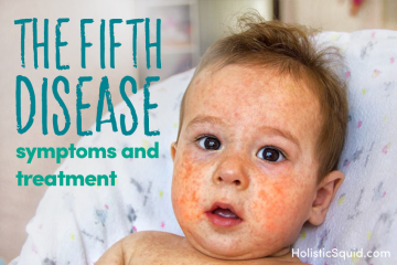 Fifth Disease Symptoms And Treatments