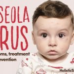 Roseola Virus: Symptoms, Treatment and Prevention
