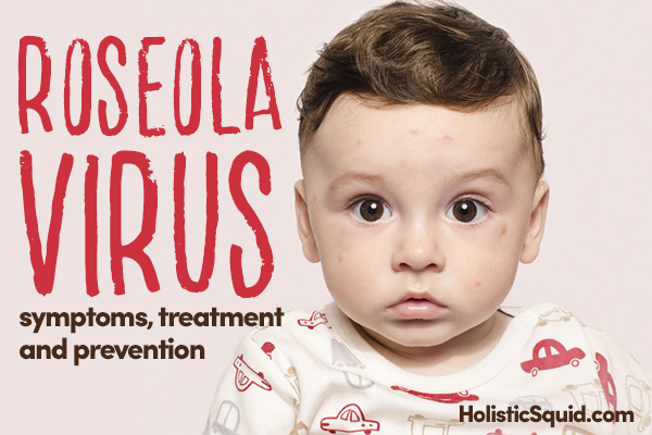 Roseola Virus: Symptoms, Treatment and Prevention - Holistic Squid