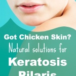 Natural Remedies for Keratosis Pilaris