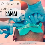Why and How to Avoid a Root Canal