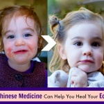 How Chinese Medicine Can Help You Heal Eczema