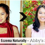 Healing Eczema Naturally – Abby’s Story
