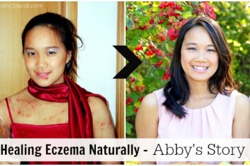 Healing Eczema Naturally - Abby's Story - Holistic Squid