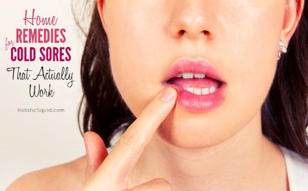 Cold Sore Home Remedies That Actually Work - Holistic Squid