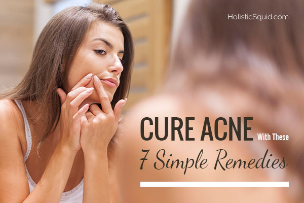 Cure Acne With These 7 Simple Remedies - Holistic Squid