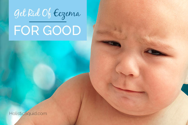 Get Rid Of Eczema For Good - Holistic Squid