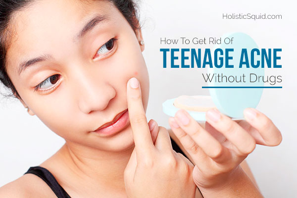 How To Get Rid Of Teenage Acne Without Drugs - Holistic Squid